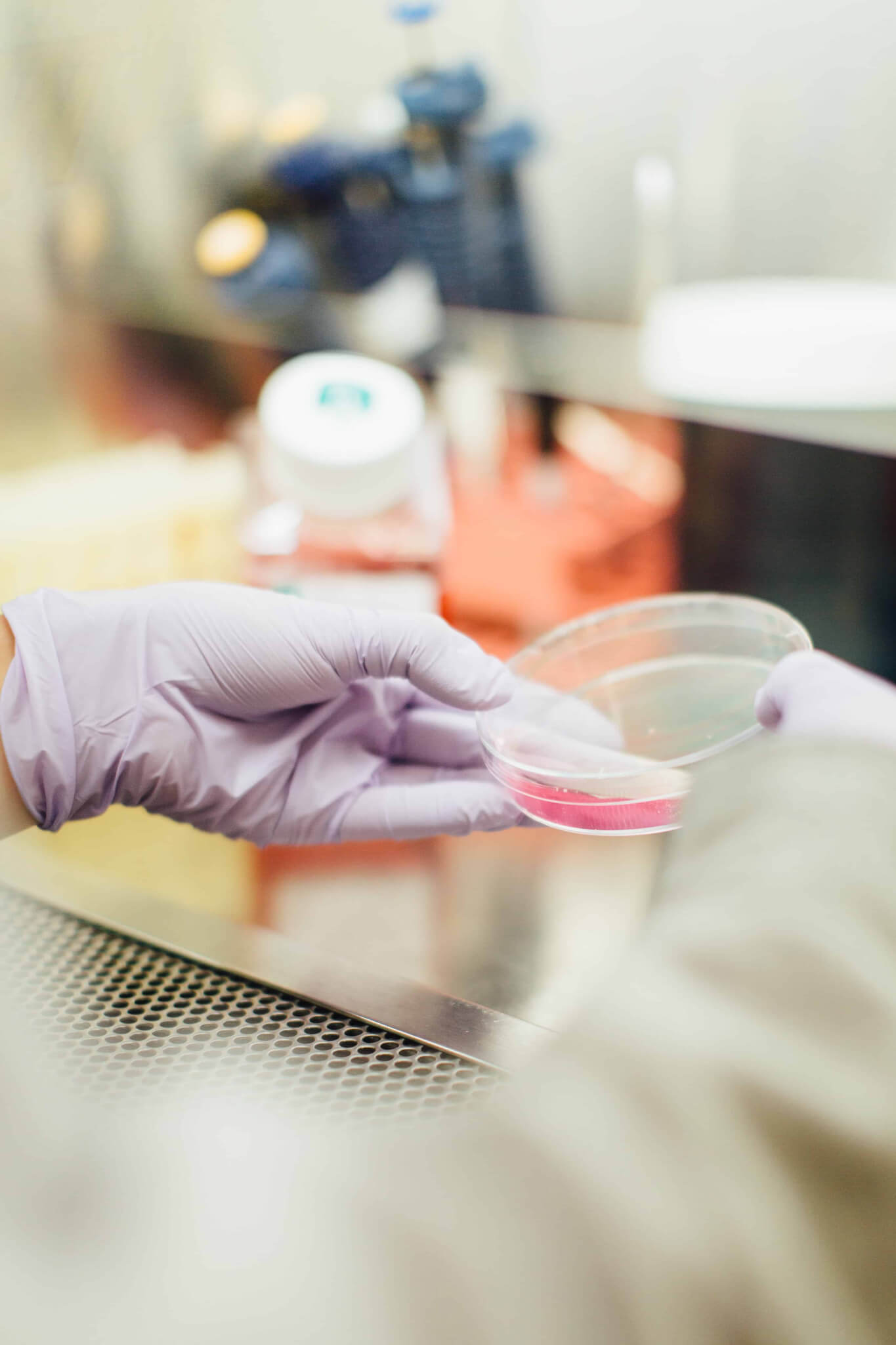 Is a Deadly New Superbug Fungus the Result of Bad Farming, Food and Pharma?