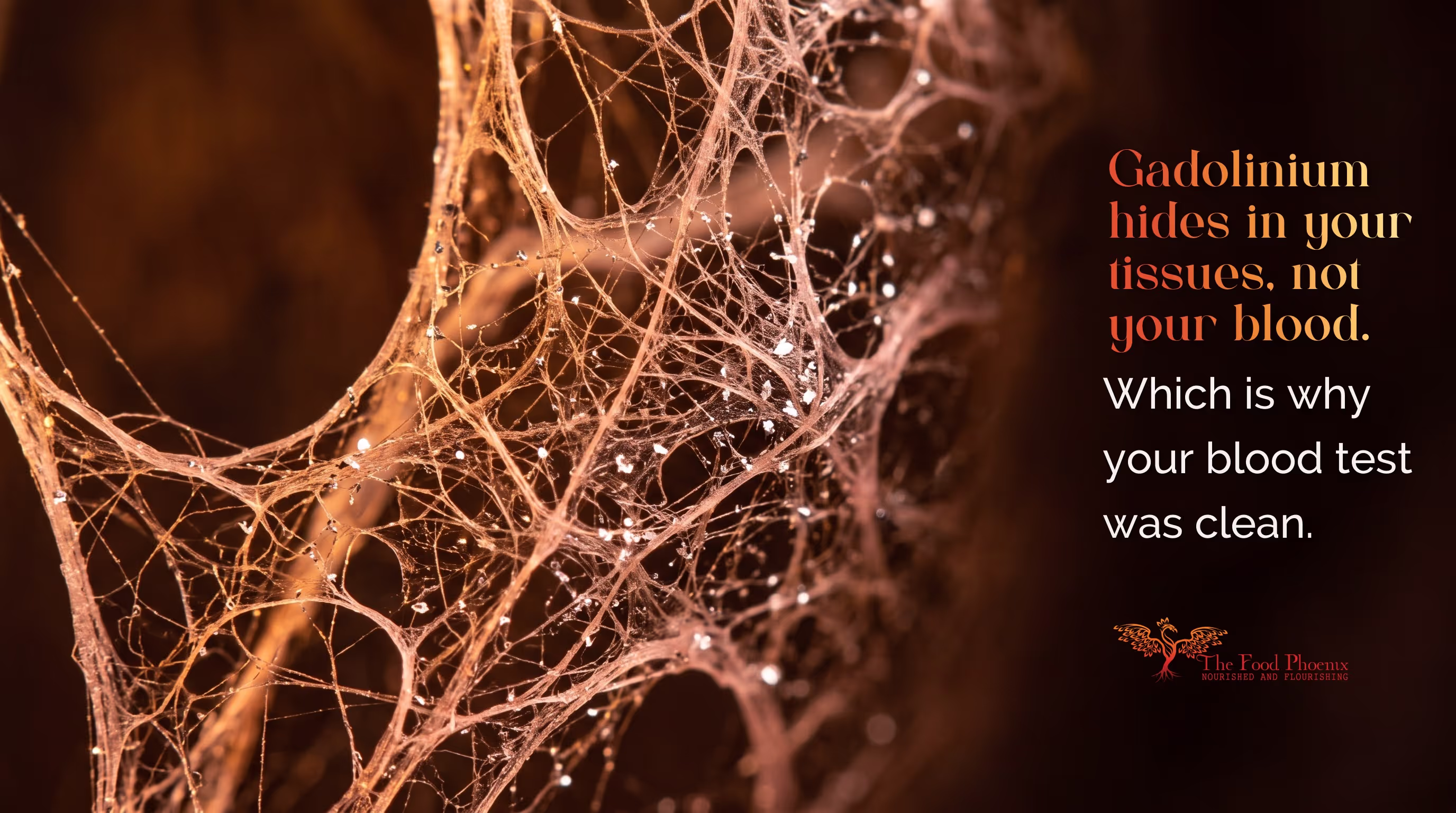 Close-up of connective-tissue fibres flecked with silver. Overlaid text: 'Gadolinium hides in your tissues, not your blood. Which is why your blood test was clean.'